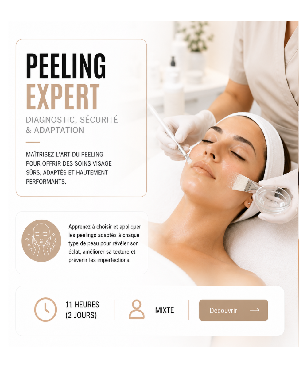 Formation Peeling Expert